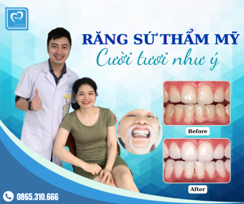lam rang su tham my
