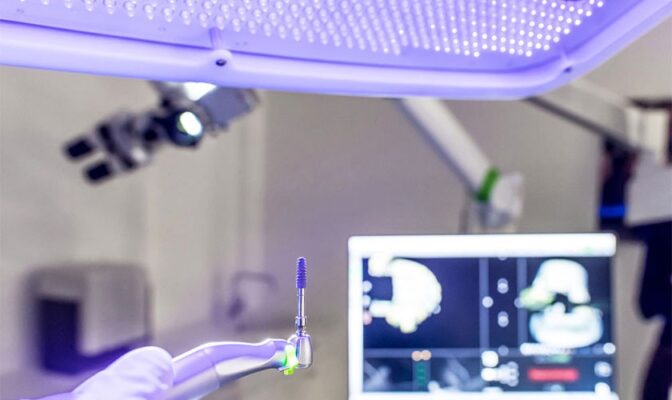 Công nghệ cấy ghép implant hiện đại nhất Thái Nguyên