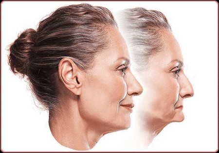 Mất răng lâu năm có trồng được không?