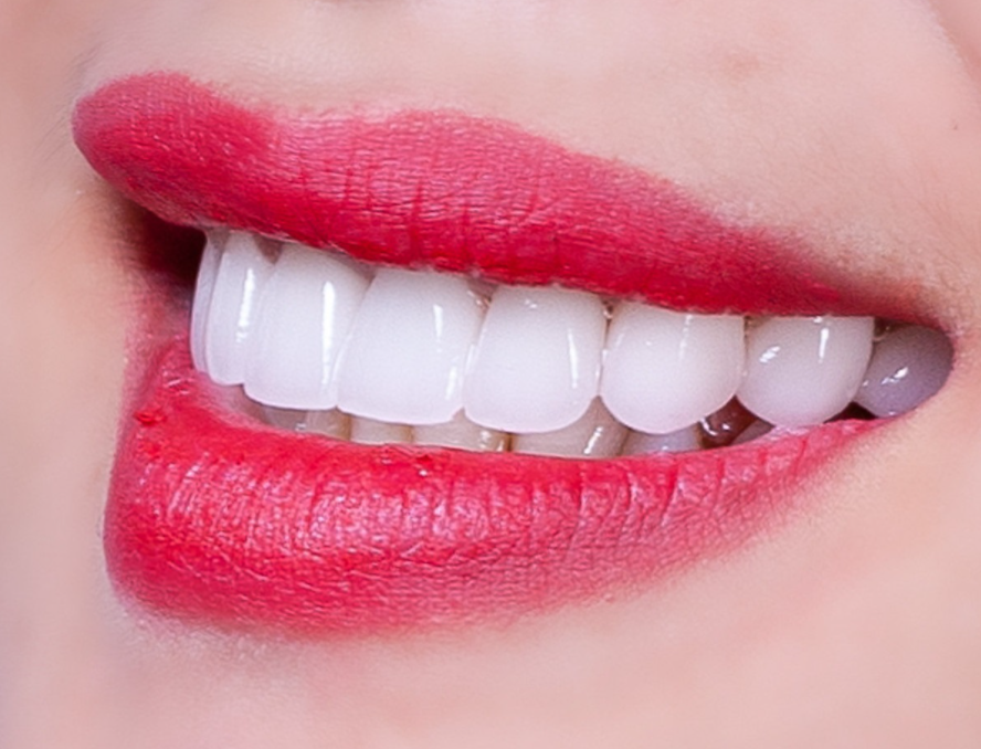 Nha Khoa Bảo Ngọc