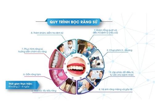 Quy trình bọc răng sứ.