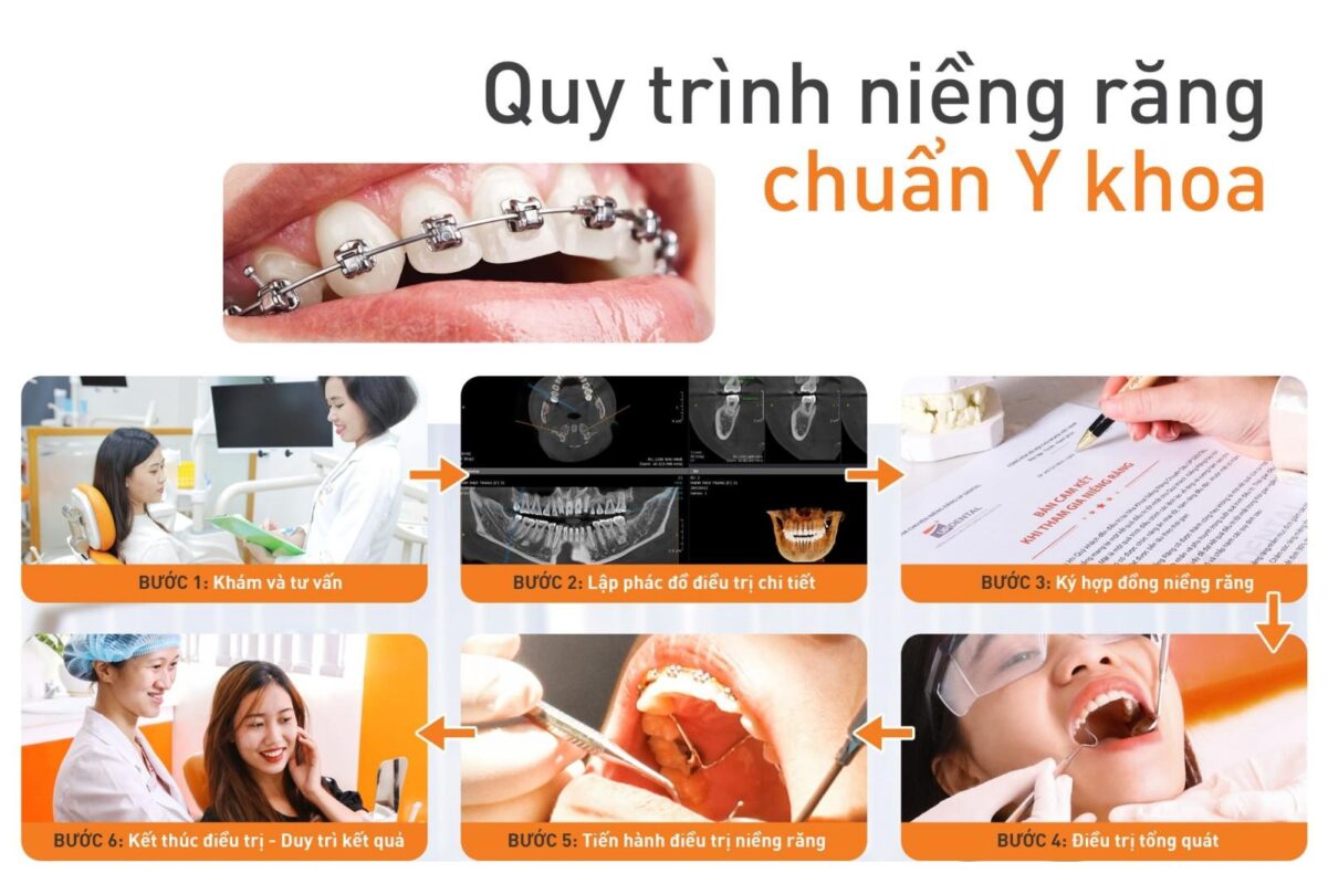 Nha Khoa Bảo Ngọc