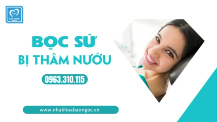 Bọc Sứ Bị Thâm Nướu