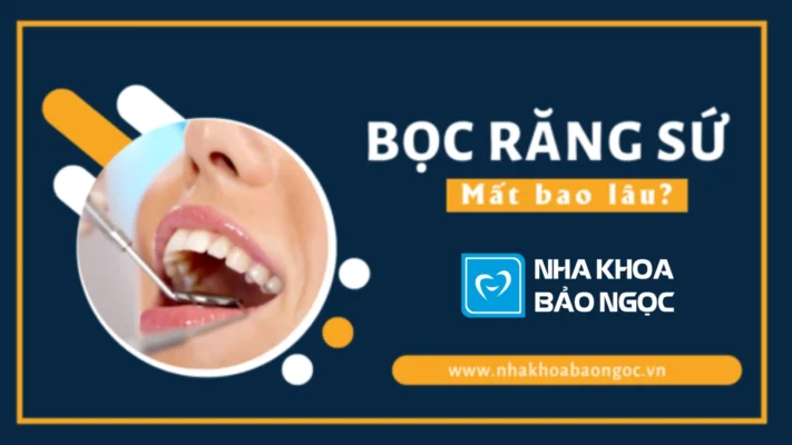 Bọc răng sứ mất bao lâu? Bọc răng sứ bao lâu thì ăn được?