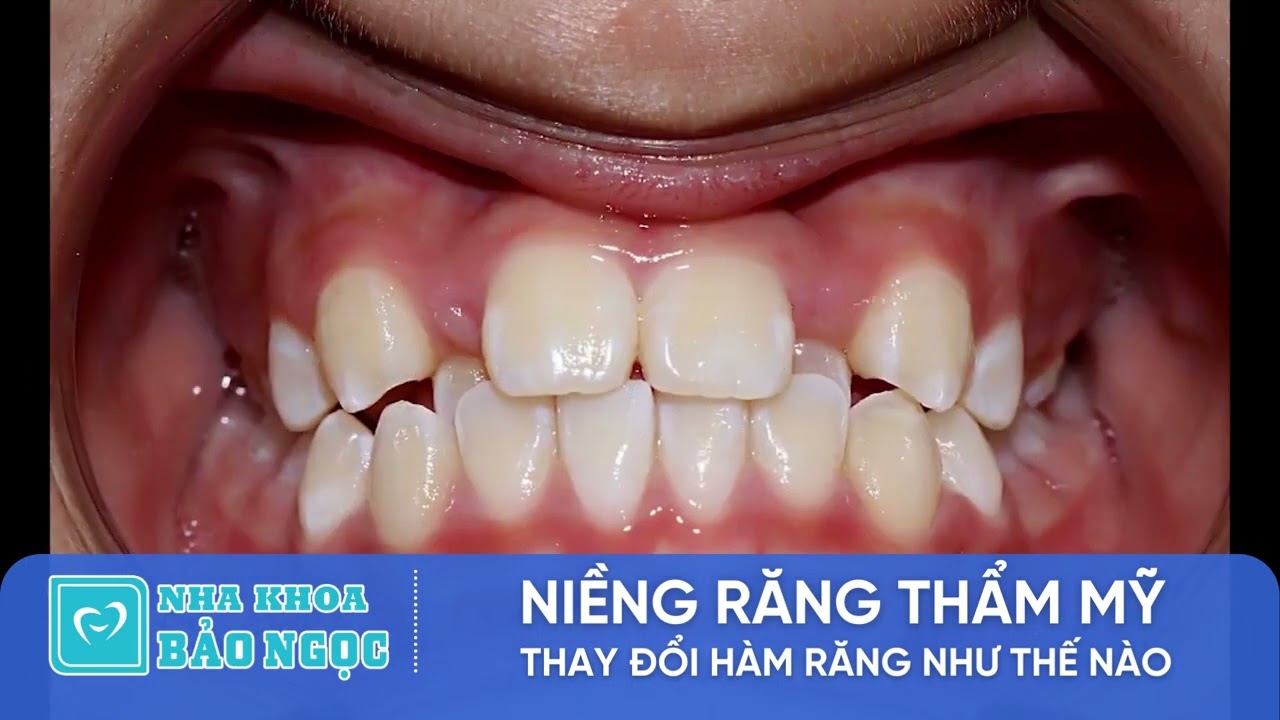 Nha Khoa Bảo Ngọc