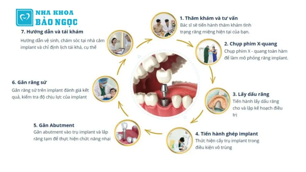 Nha khoa cấy ghép implant hàng đầu Thái Nguyên