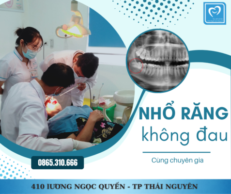 nho rang khon khong dau