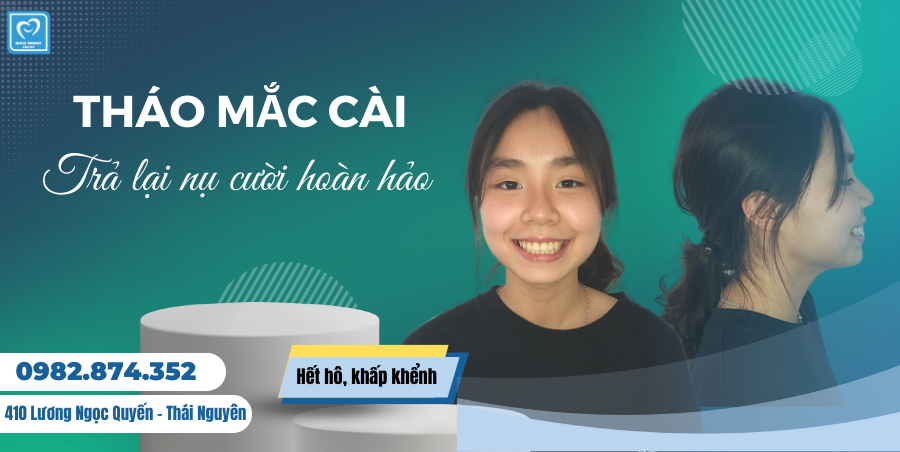 Nụ cười tự tin sau tháo mắc cài