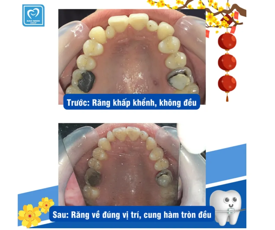 Kết thúc hành trình 2 năm tìm lại nụ cười xinh