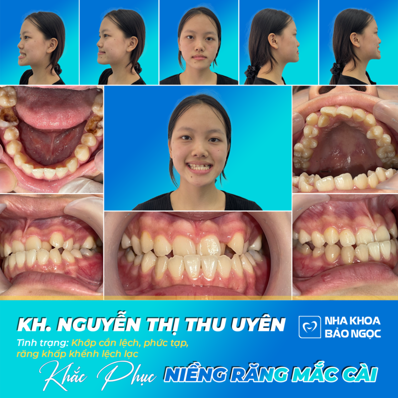 Nha Khoa Bảo Ngọc