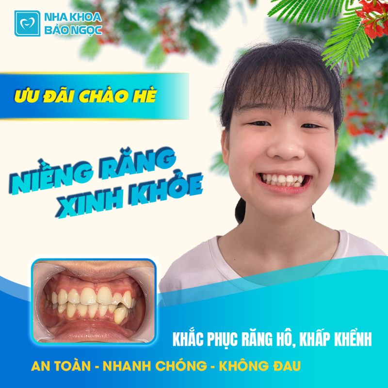 Nha Khoa Bảo Ngọc