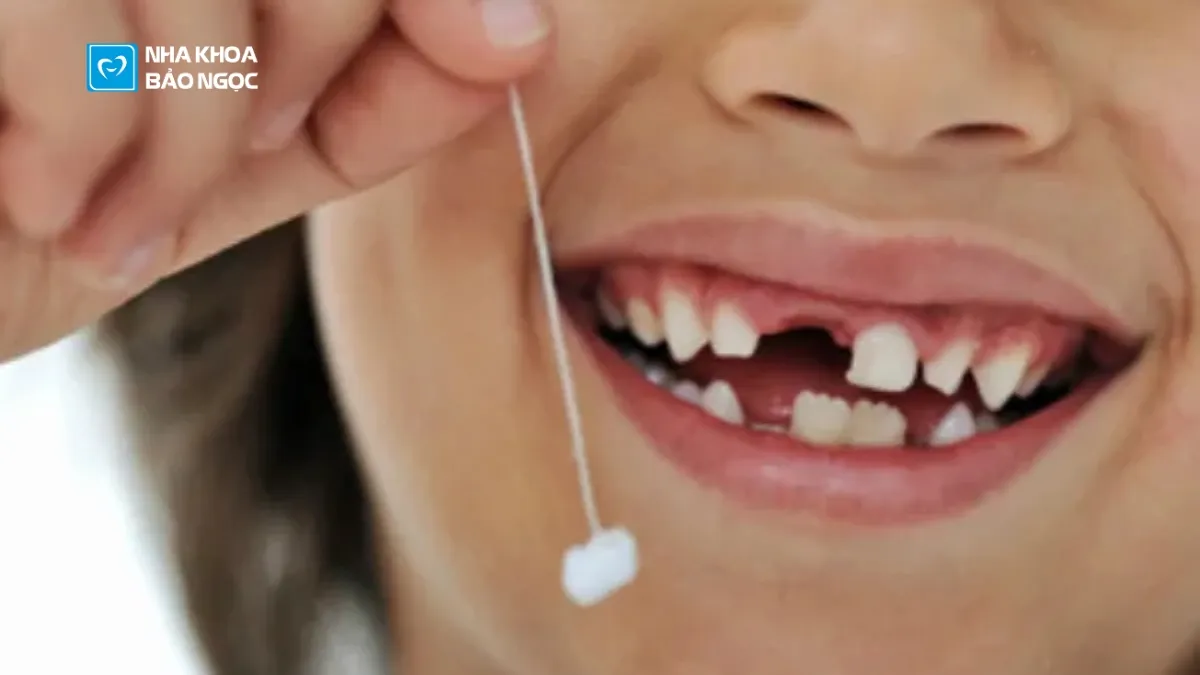 Để con trẻ có 1 hàm răng đều đặn, tránh hô móm!