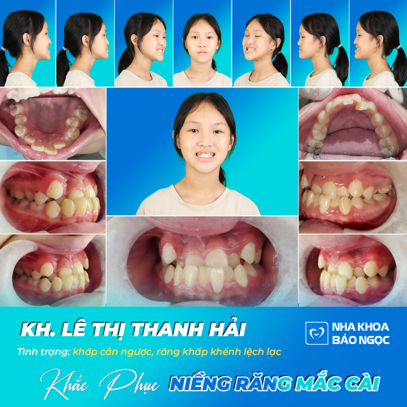 Nha Khoa Bảo Ngọc
