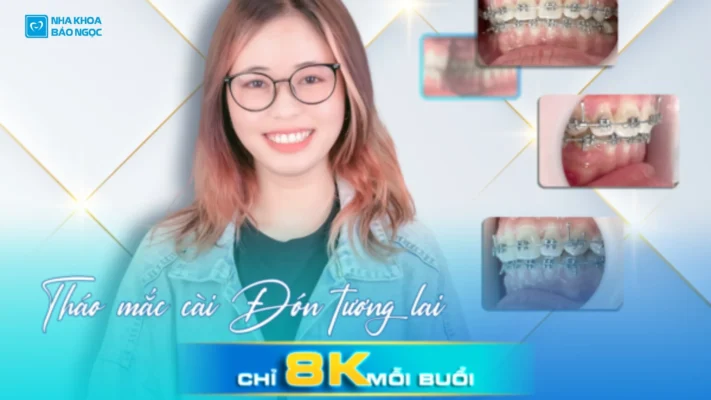 Niềng răng sẽ thay đổi bạn như thế nào ? Tháo mắc cài, đón tương lai cùng bạn M.H 19 tuổi