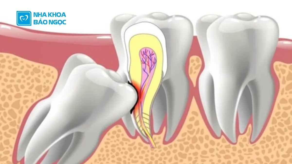 13 bệnh về răng miệng cần đặc biệt lưu ý