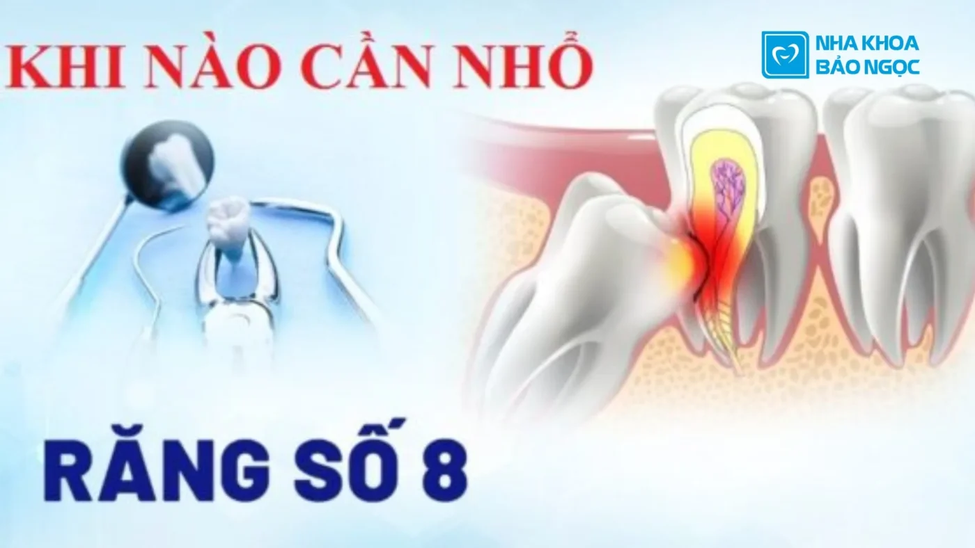 Răng Số 8 Đang Đau: Nguyên Nhân, Cách Giảm Đau Hiệu Quả