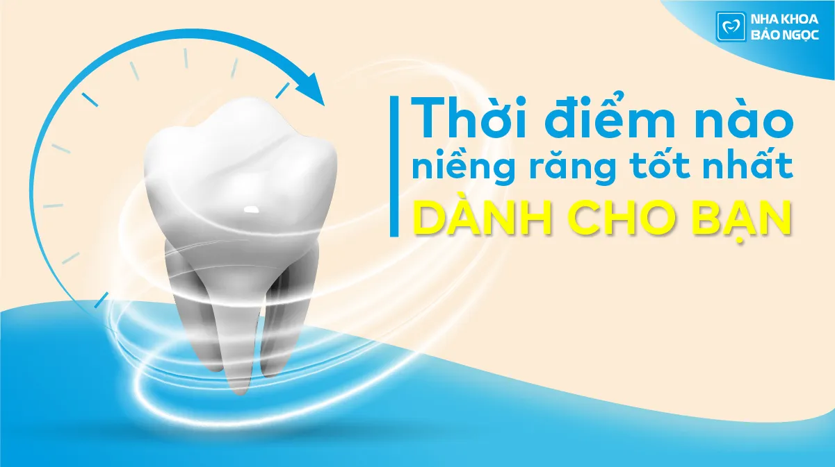 Thời điểm nào niềng răng tốt nhất dành cho bạn?