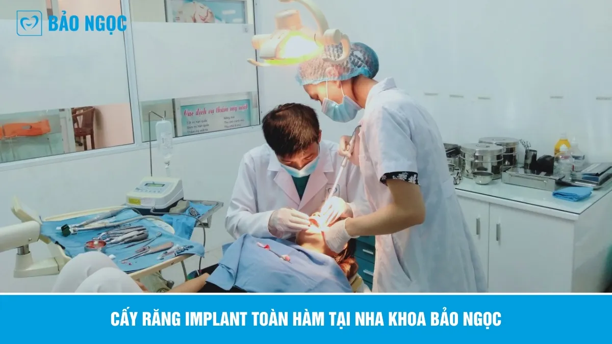 Cấy ghép Implant toàn hàm