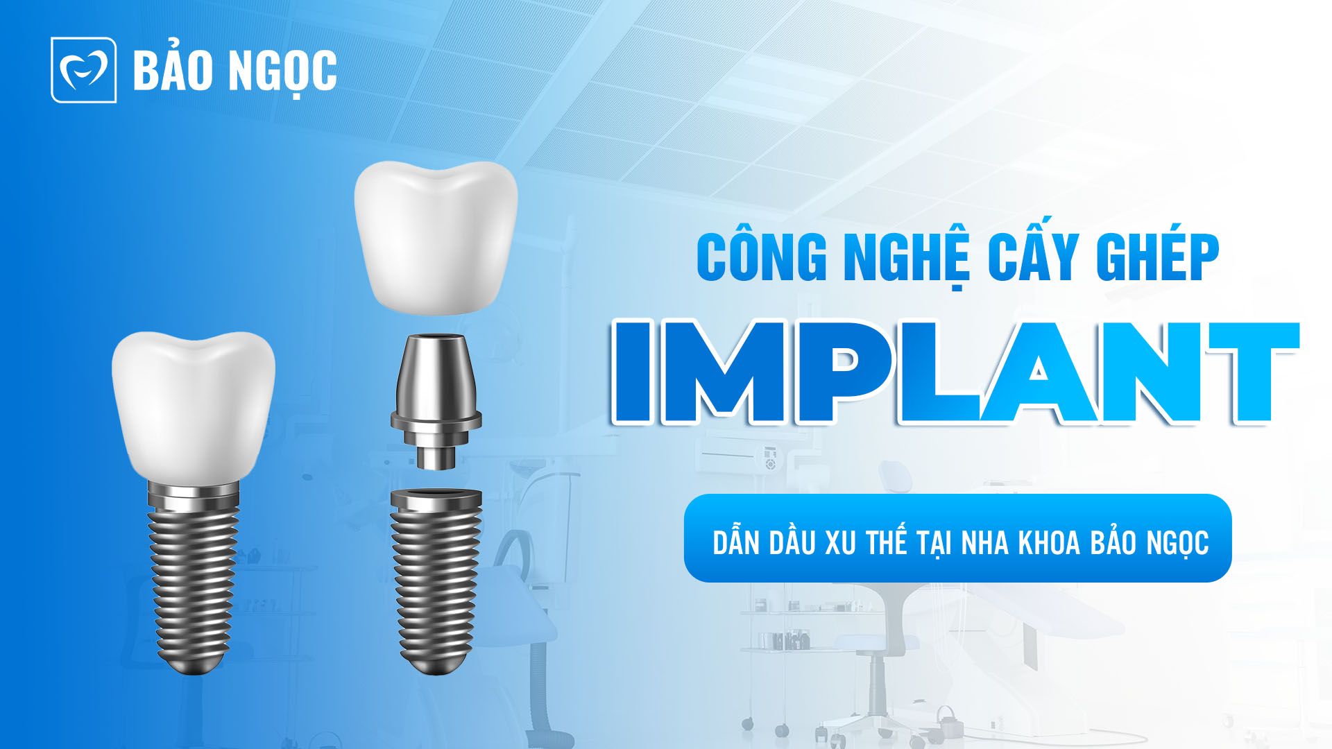 Công nghệ cấy ghép Implant