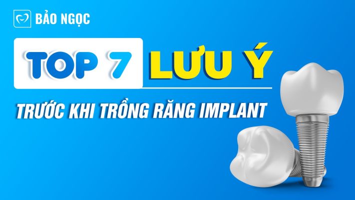 lưu ý trước khi trồng răng Implant