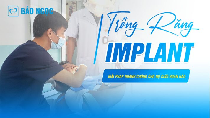 Trồng răng Implant tức thì