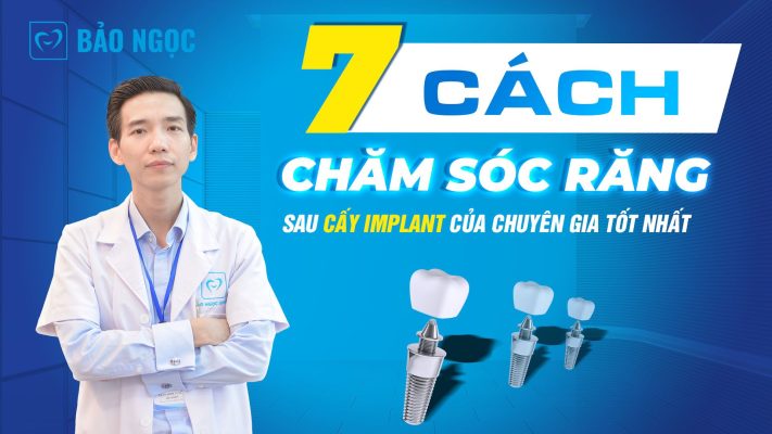 Cách chăm sóc răng sau cấy Implant