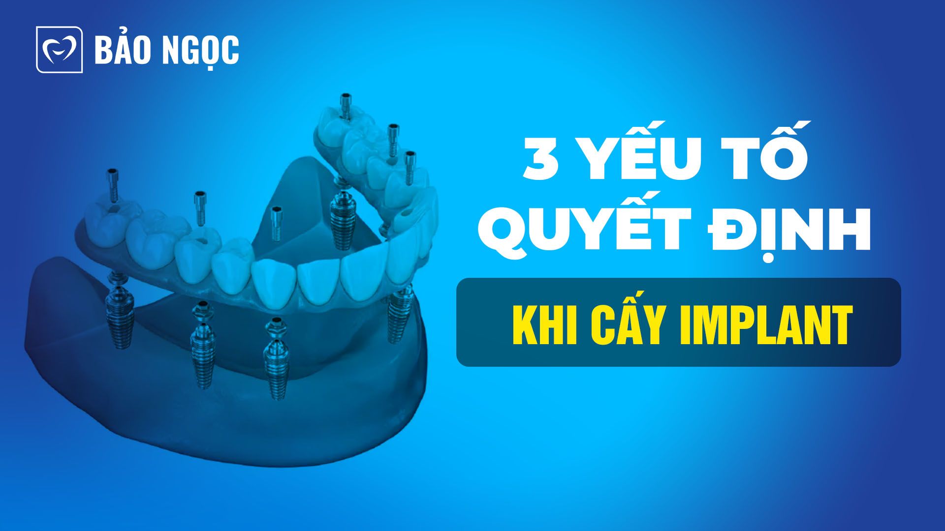 cấy Implant không đau