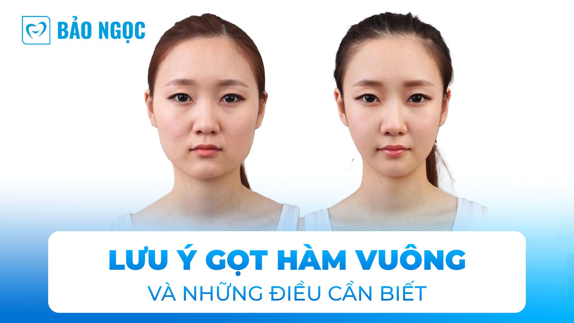 gọt hàm vuông 