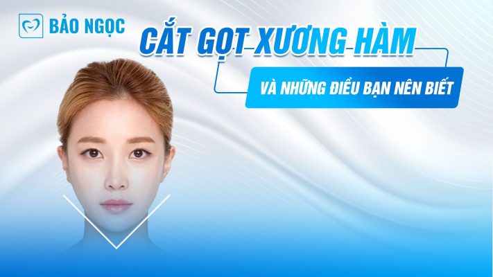 Cắt gọt xương hàm