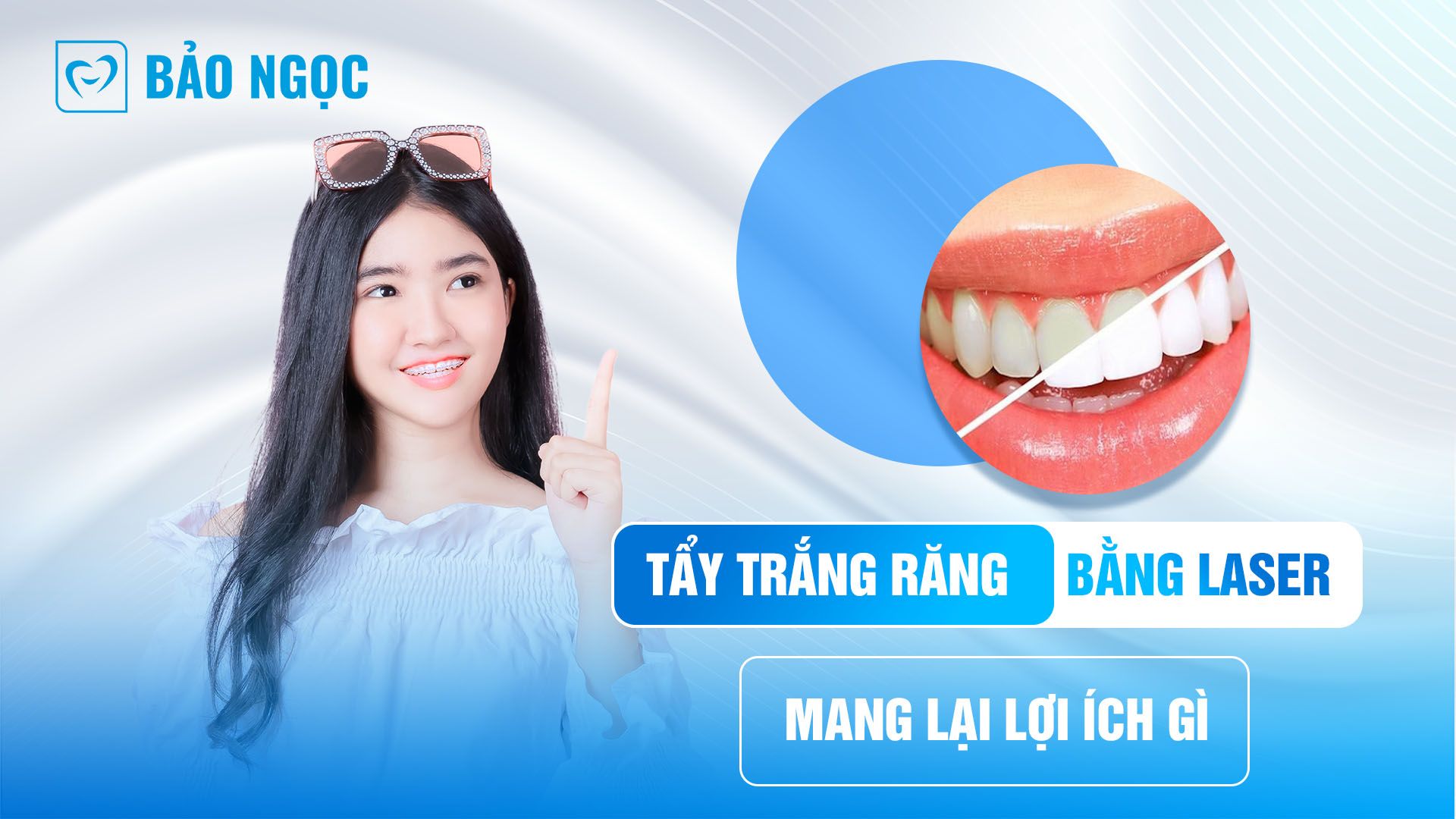 Tẩy trắng răng bằng laser