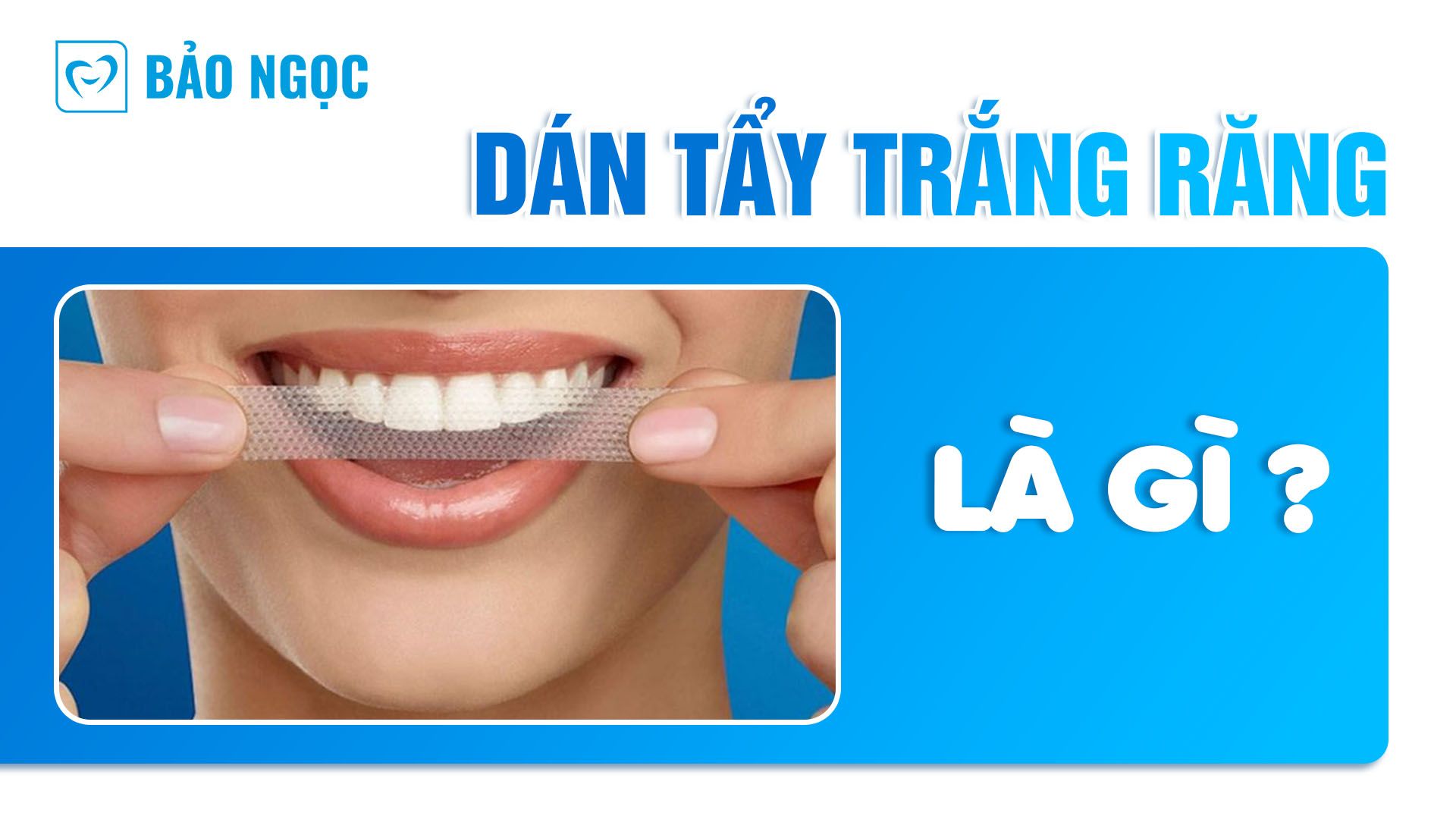 Dán tẩy trắng răng