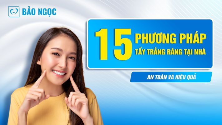 phương pháp tẩy trắng răng tại nhà