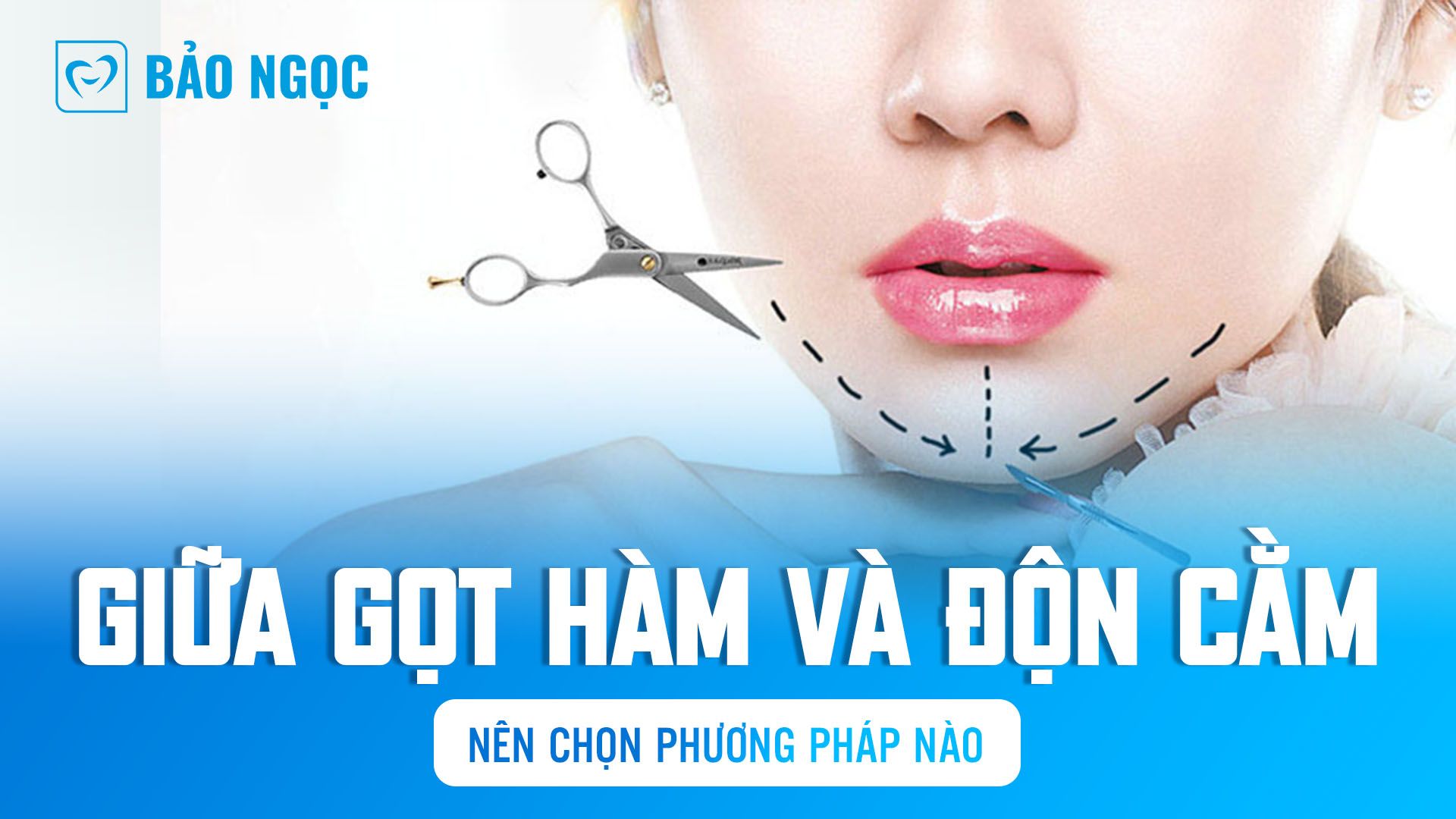 Giữa gọt hàm và độn cằm