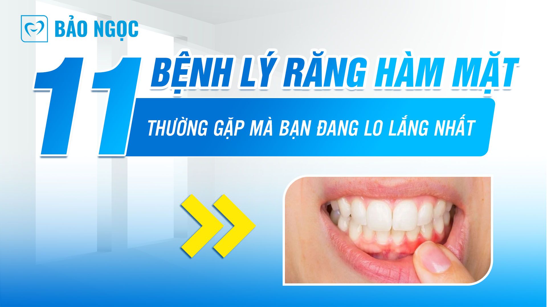 bệnh lý răng hàm mặt