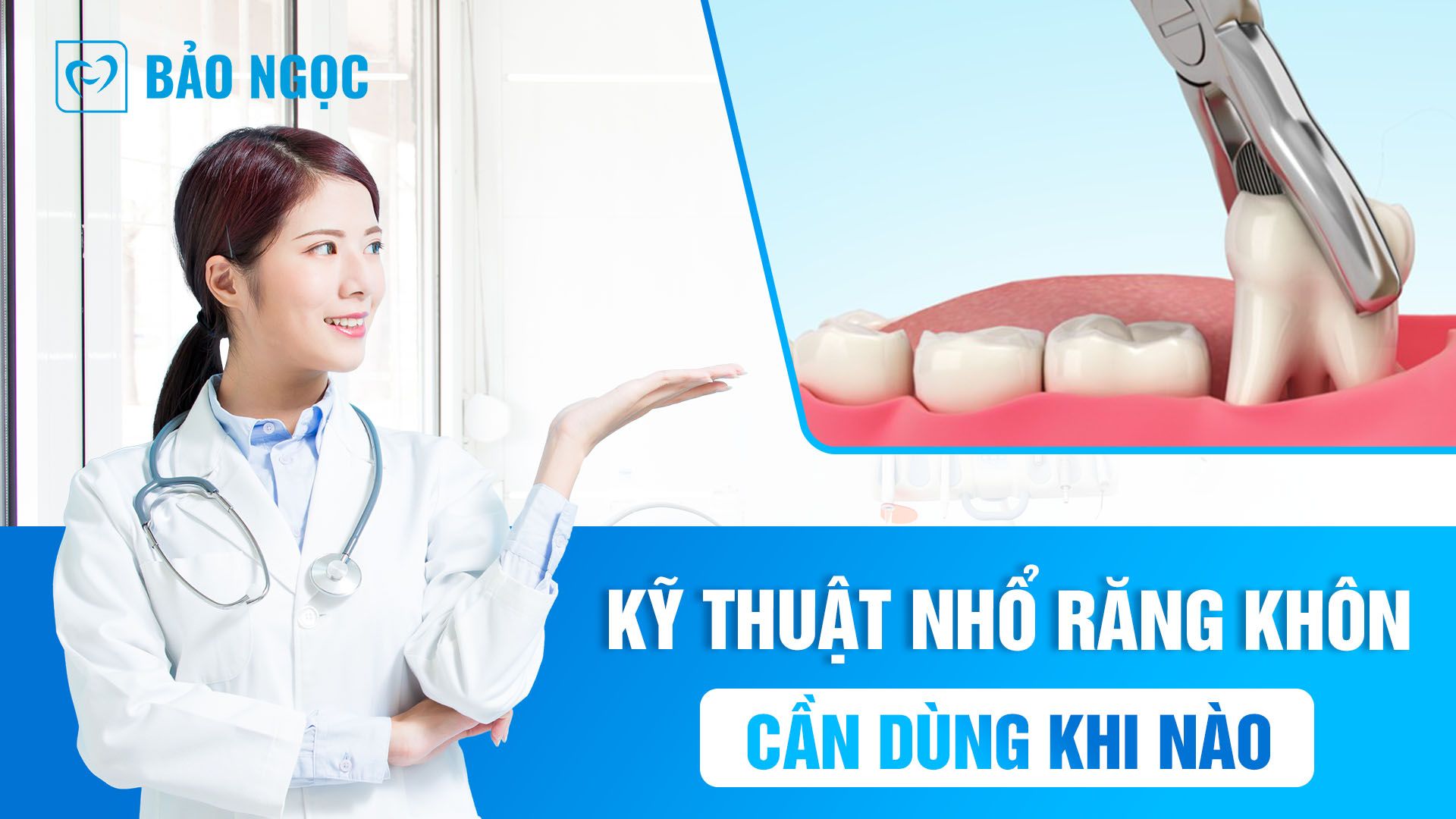 Kỹ thuật nhổ răng khôn cần dùng khi nào? Các bước trong quy trình