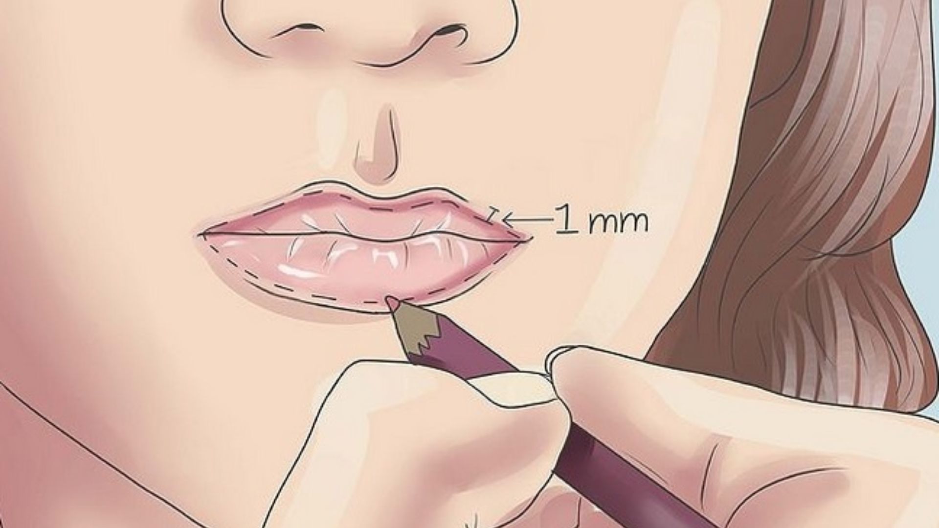 Phẫu thuật môi dày thành mỏng như thế nào? Những ai cần thực hiện