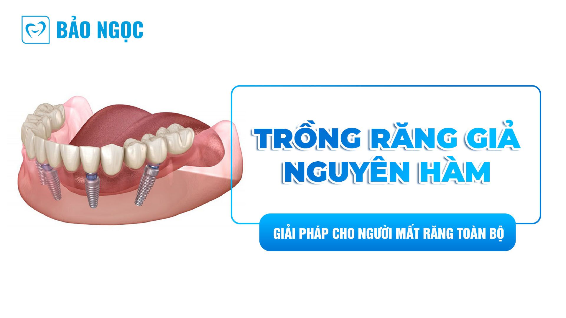 Trồng răng giả nguyên hàm