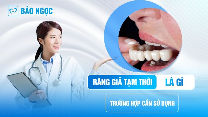 Răng giả tạm thời là gì? Tính năng của nó và trường hợp cần sử dụng