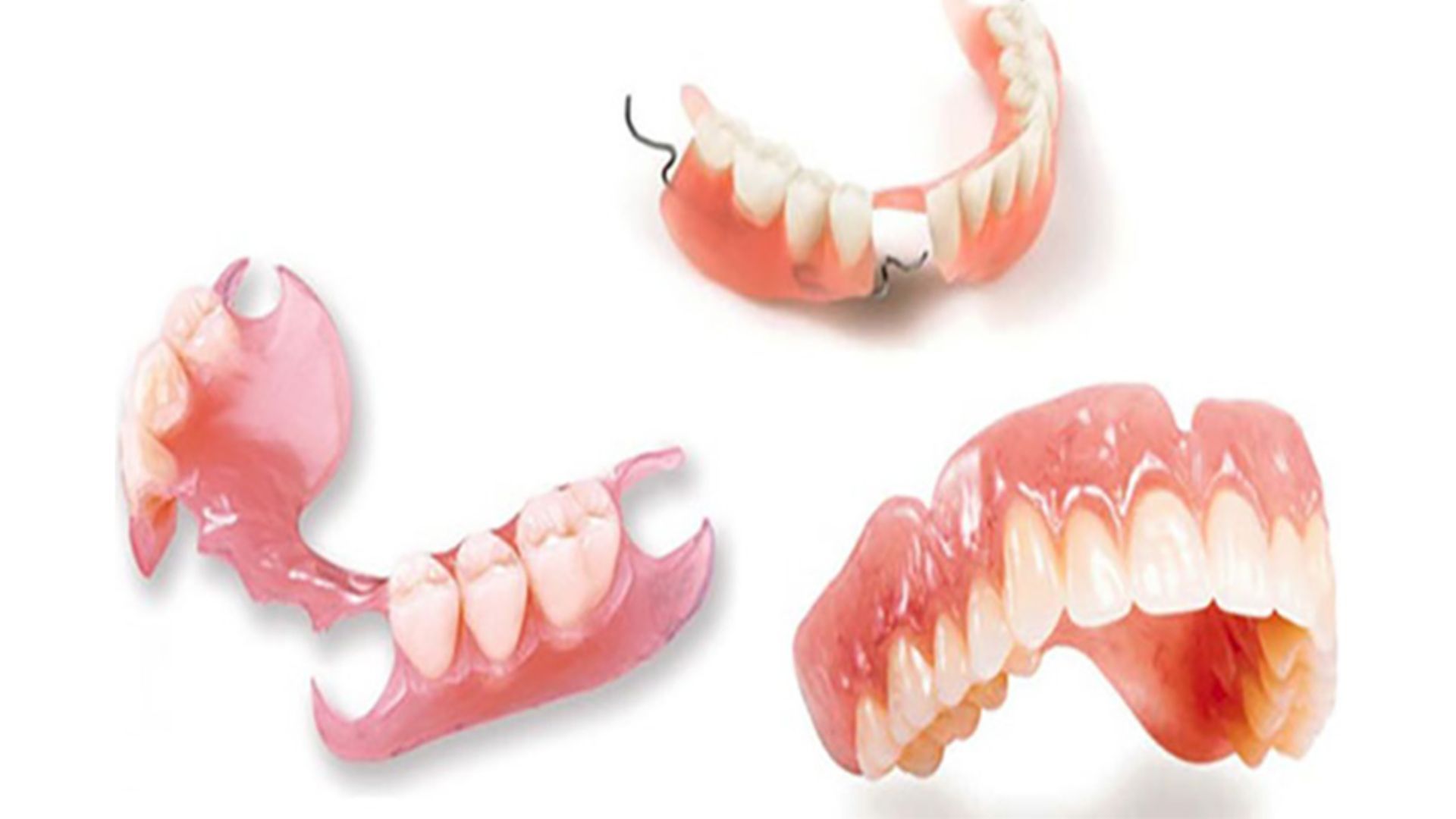 Phục hình răng là gì Có những phương pháp nào được ứng dụng phổ biến