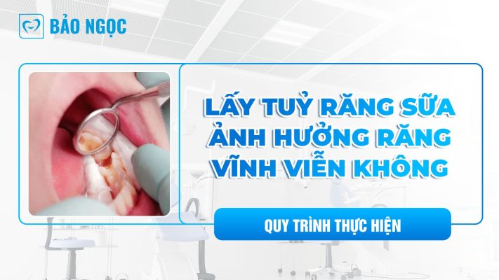 Lấy tuỷ răng sữa ảnh hưởng răng vĩnh viễn không? Quy trình thực hiện