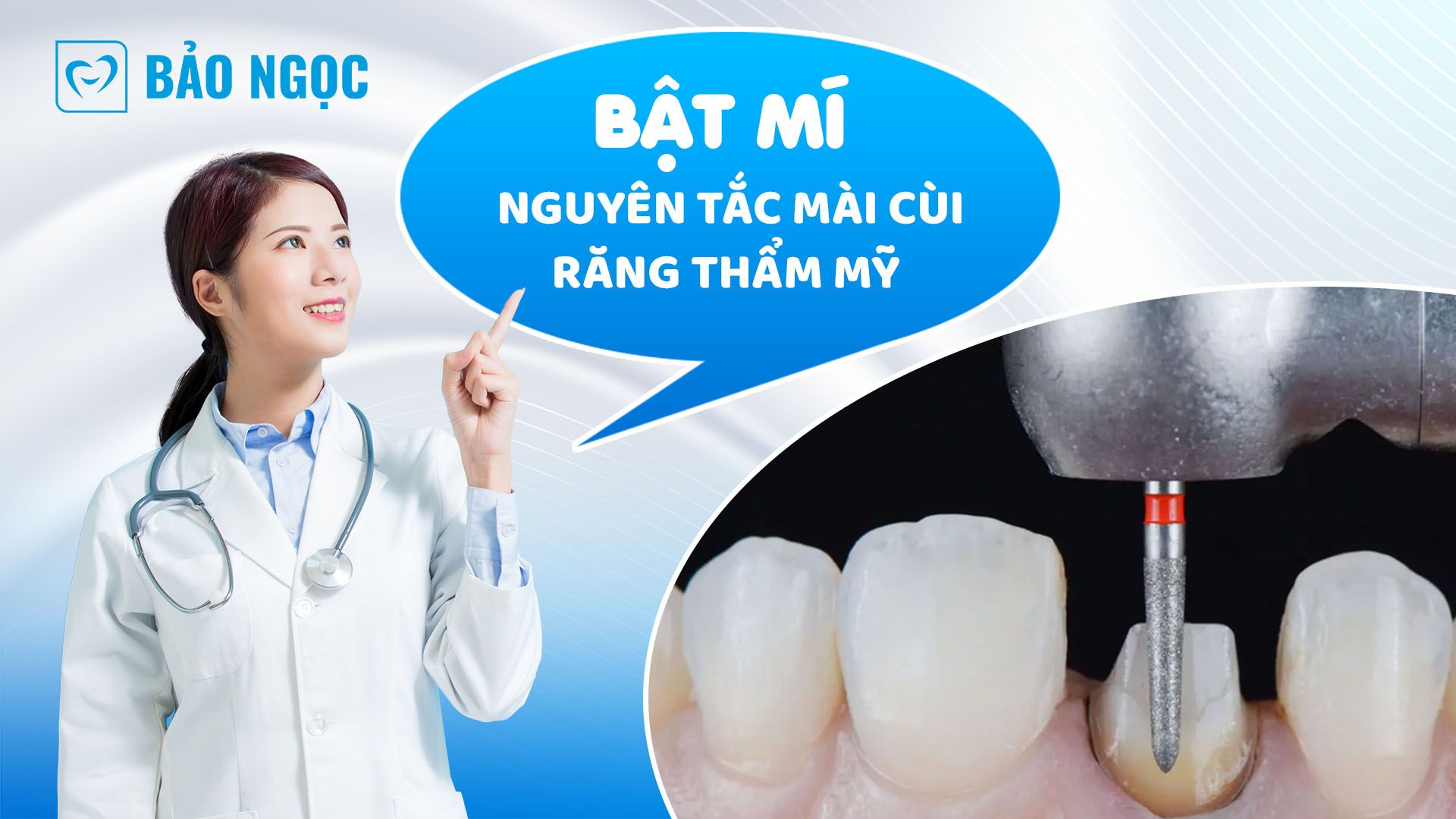 Bật mí nguyên tắc mài cùi răng thẩm mỹ không phải ai cũng biết