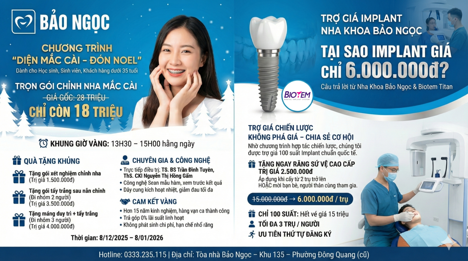 [BIG DEAL] Trồng Implant 6.000.000đ – Niềng răng 18.000.000đ tại Nha khoa Bảo Ngọc