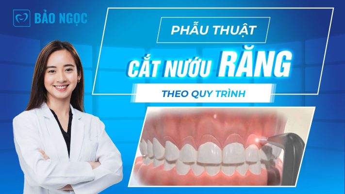 Phẫu thuật cắt nướu răng theo quy trình thực hiện thế nào? Lưu ý